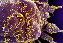 Detectan a “Deltacron”, una nueva variante de COVID-19 que combina Ómicrom y Delta