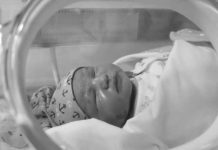 Bebé nació con una “cola humana” de 12 centímetros de largo y sorprendió a los médicos