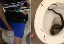 Se sentó en el inodoro, una cobra le mordió el pene y se lo “mató”