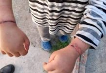 Rescataron a un nene de 6 años que había sido atado con alambre por su mamá